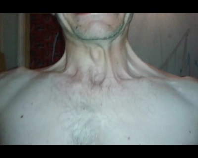 zdjęcie dziwnego tworu pod skórą szyi Tomasza Musielaka, konsekwencji tajnego eksperymentu na niewinnym człowieku