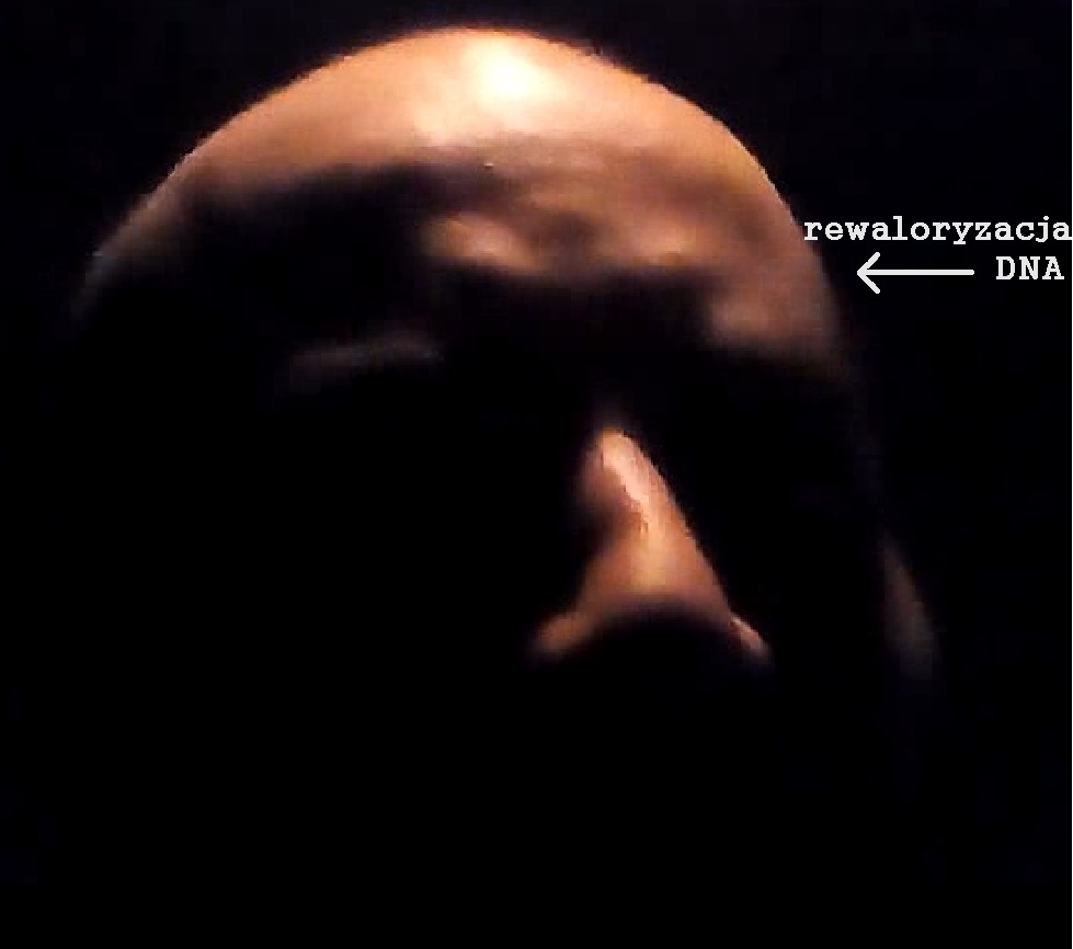 zdjęcie zmian twarzoczaszki Tomasza Musielaka wywołanych przez rekonfigurację DNA